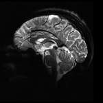 image for The living human brain captured by the world’s most powerful MRI machine