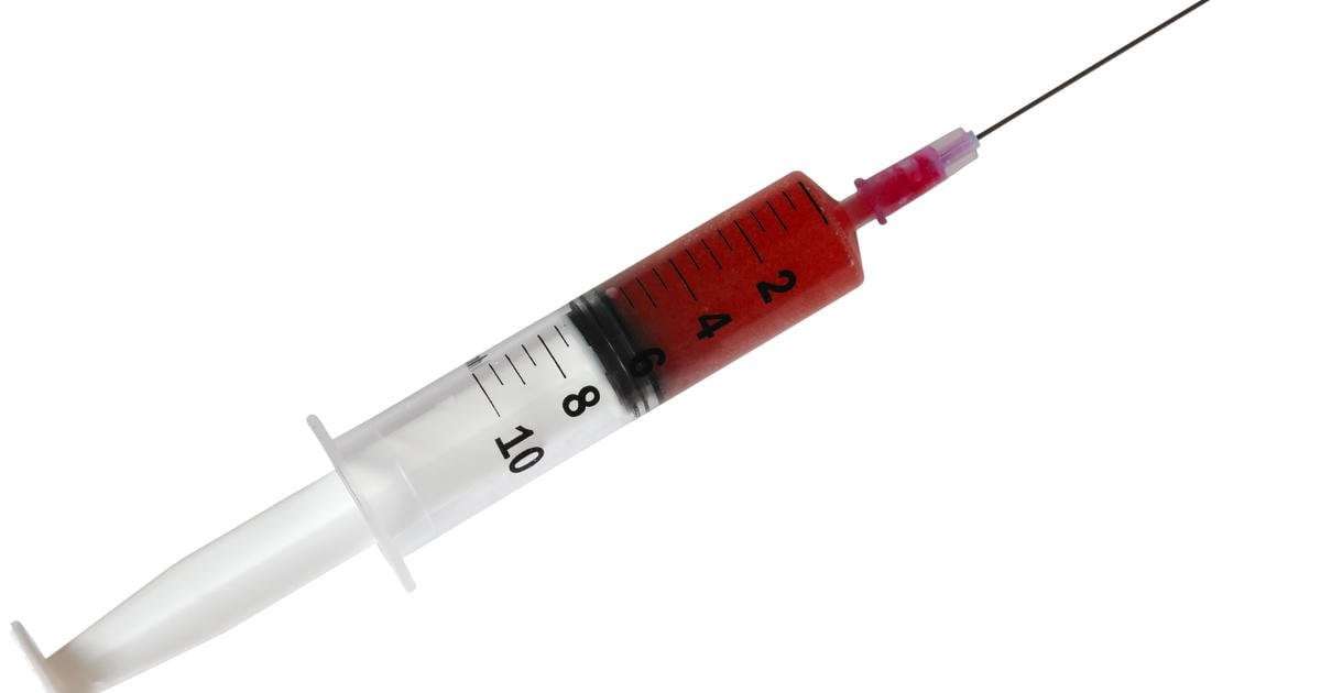 image for "Vampire facials" at an unlicensed spa infected three people with HIV, CDC finds