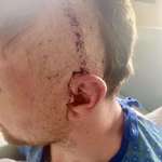 image for My little brother is at home recovering from brain surgery. Head-related gift ideas are welcome.