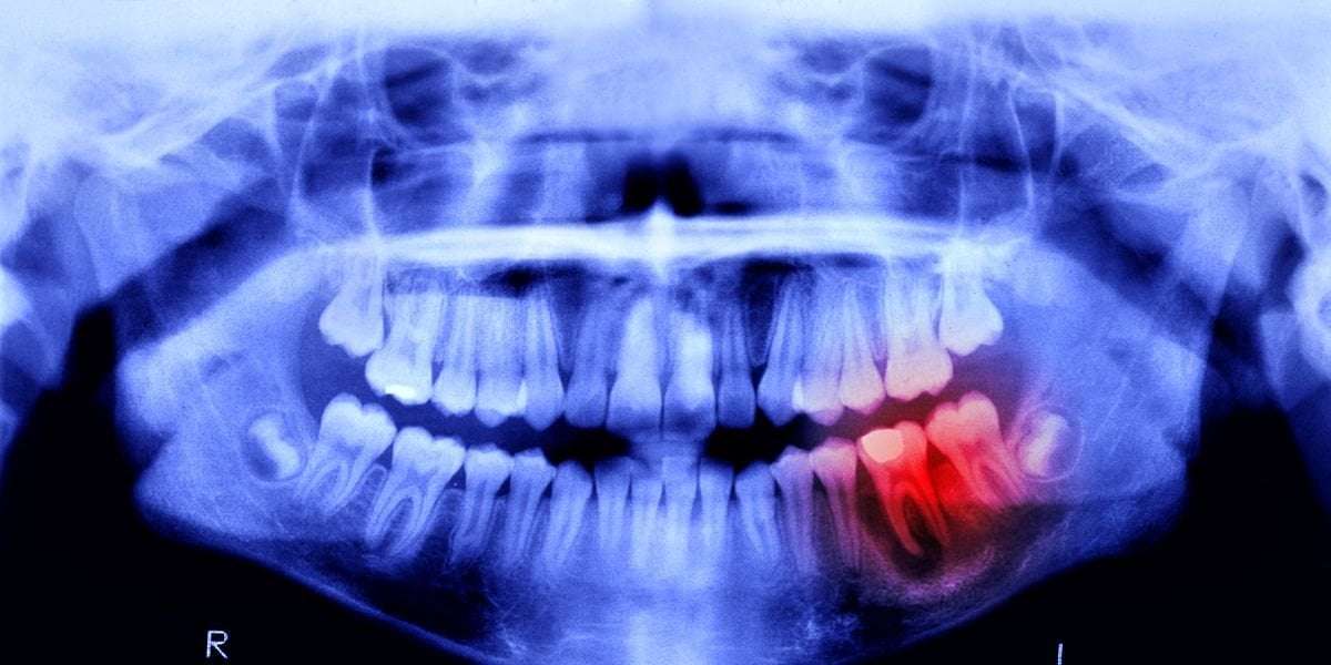 image for Humans May Be Able to Grow New Teeth Within Just 6 Years