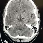 image for Picture of my skull after being hit with brass knuckles