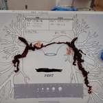 image for The Pulmonary Embolism that almost took me out. Probably most terrifying experience of my life.