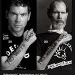 image for An ALS patient from diagnosis to now.