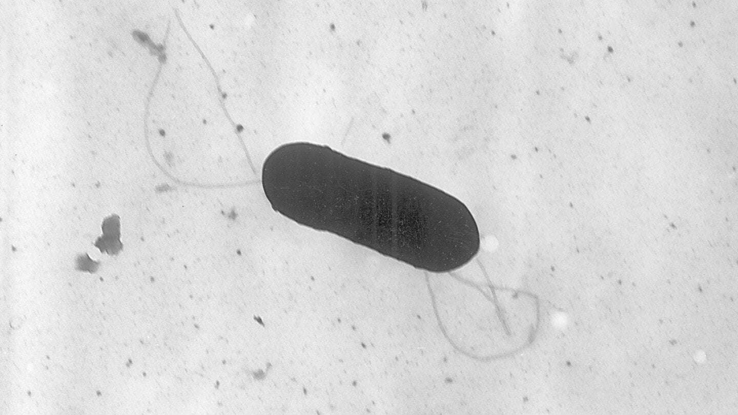 image for Here’s what to do with deli meats as the CDC investigates a listeria outbreak across the U.S.