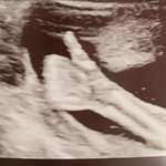 image for Baby let us know everything is all good in there 👍