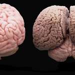 image for A Human Brain On The Left, A Dolphin Brain On The Right