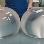 image for 4000cc breast implants.