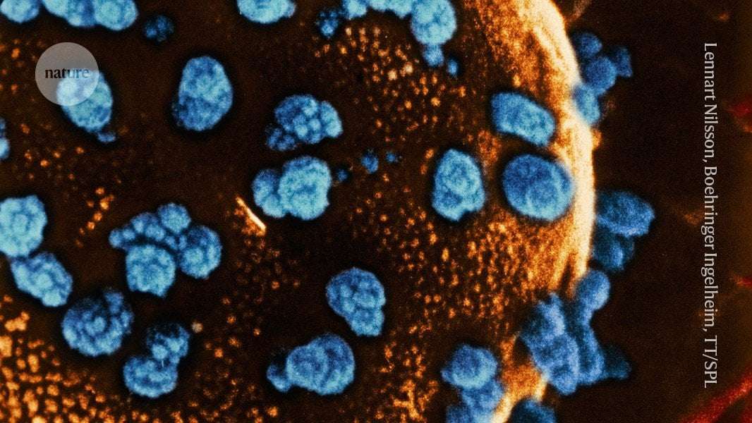 image for Stem cells reverse woman’s diabetes — a world first