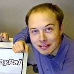 image for Elon Musk before Hair Transplants