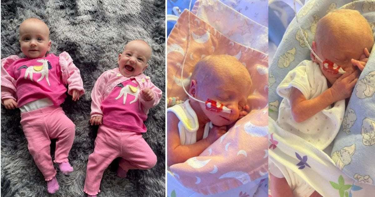image for Miracle twins given just 10% chance of survival now thriving thanks to hero medics