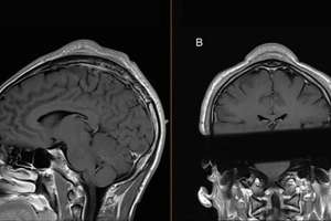 image for 