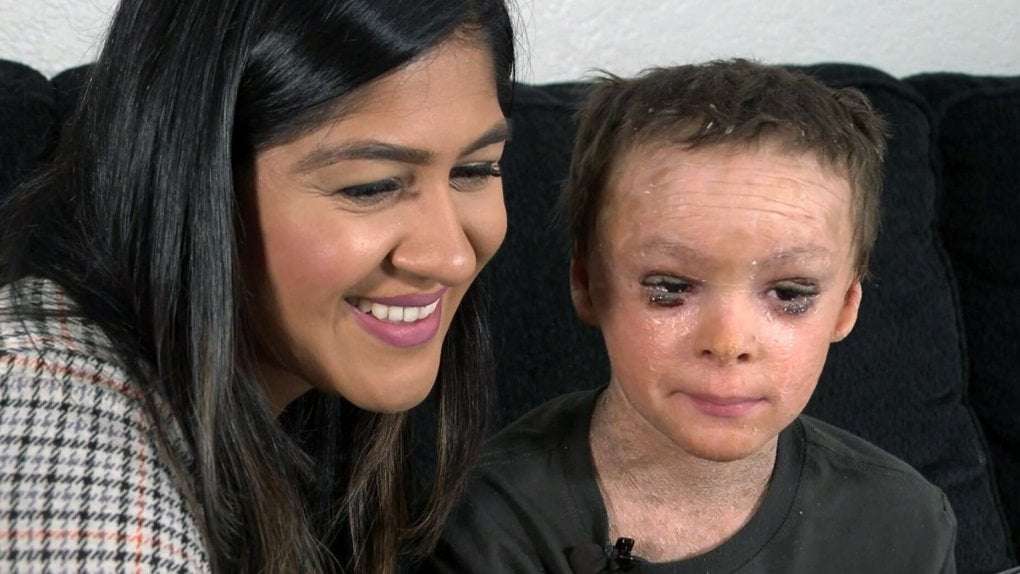 image for Nevada boy able to sleep with his eyes closed for the first time
