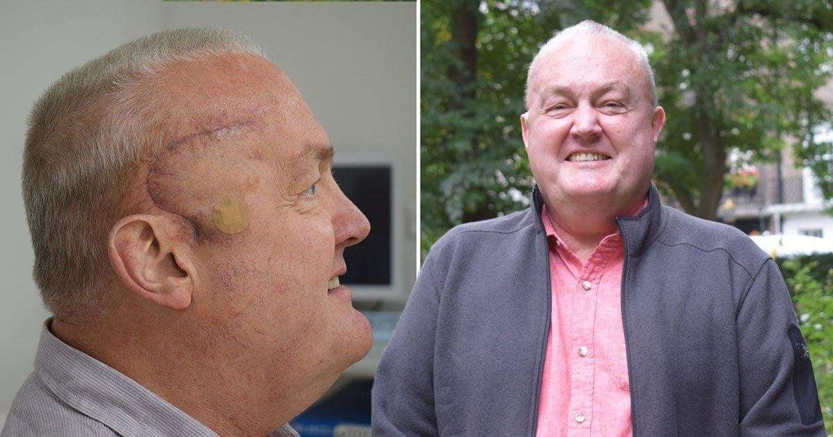 image for Man sees deadly brain tumour shrink by half thanks to new treatment