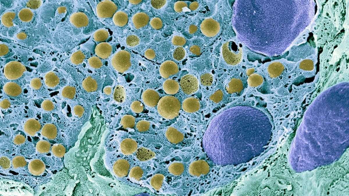 image for In a 1st, scientists reversed type 1 diabetes by reprogramming a person's own fat cells