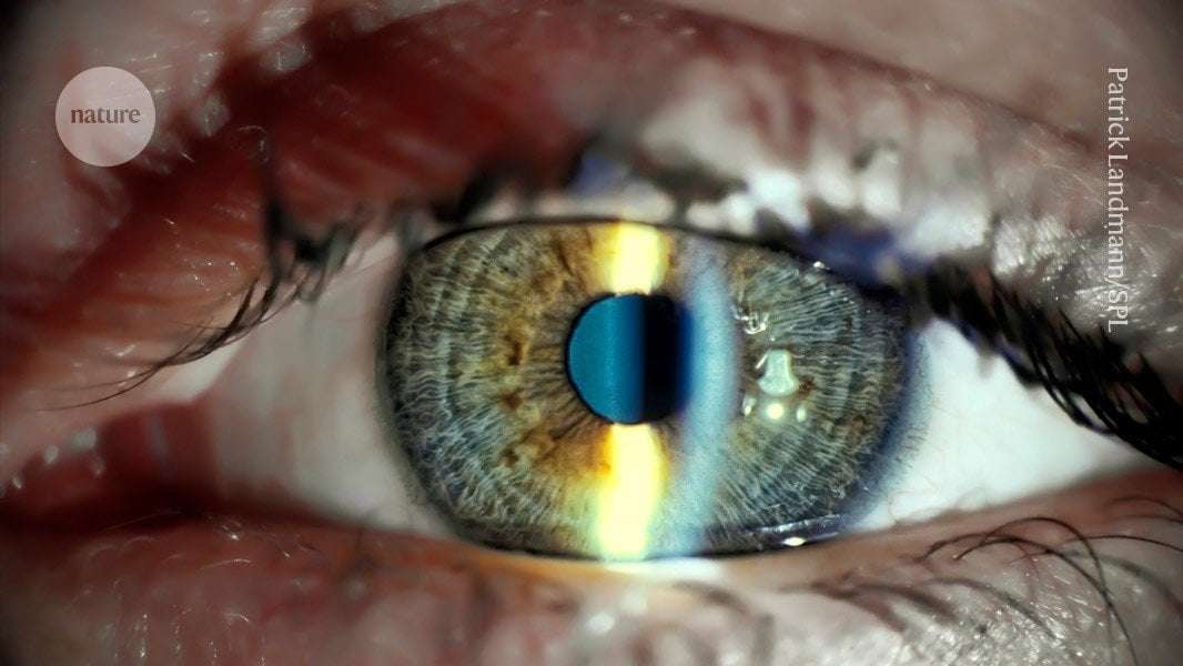 image for World-first stem-cell treatment restores vision in people