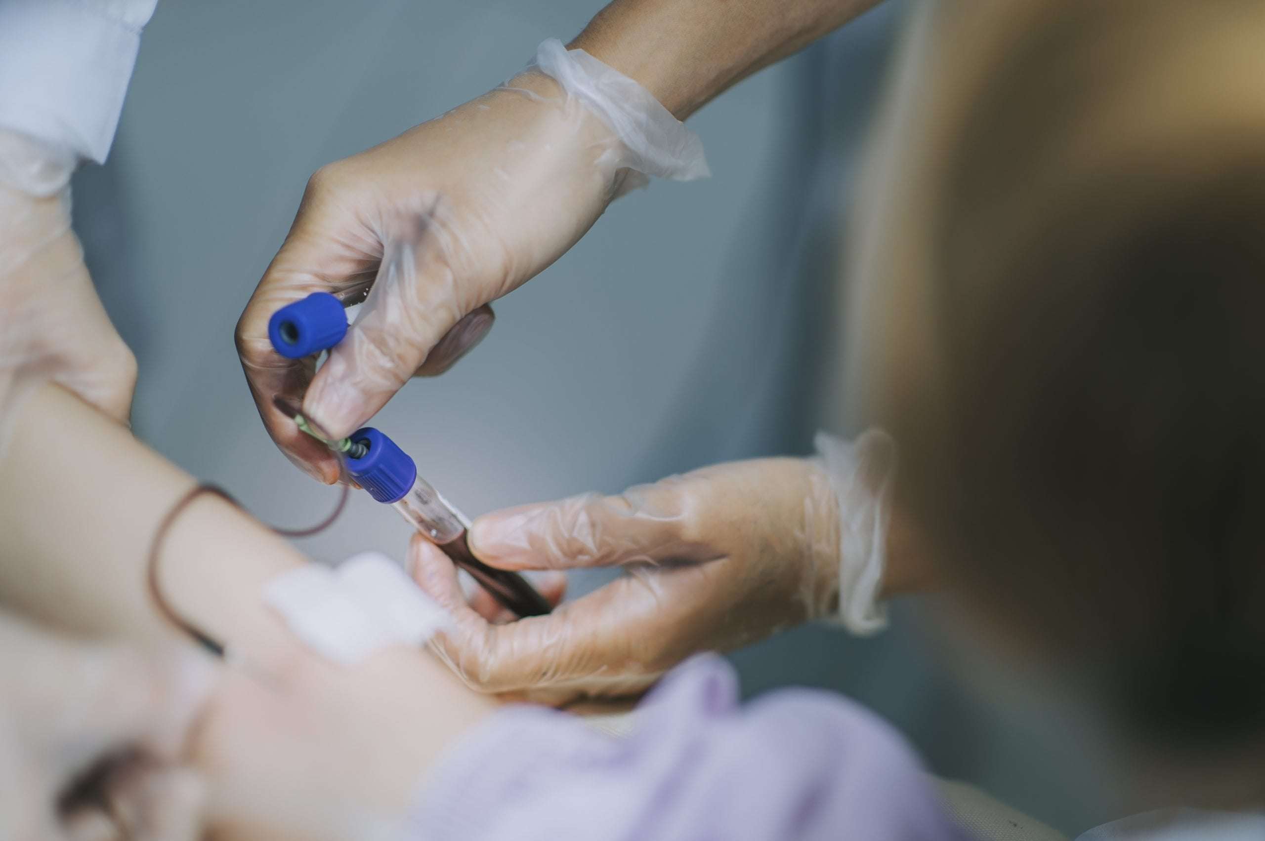 image for New Blood Test Launched In The UK Can Detect Alzheimer’s With 90% Accuracy