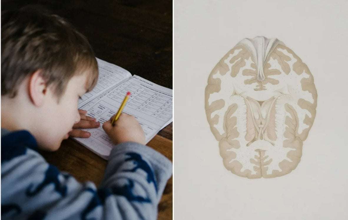 image for Surprising 16-year-long ADHD study reveals opposite of what researchers expected