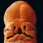 image for The face of a 5-week-old fetus.