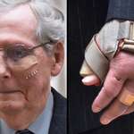 image for Mitch McConnell's injuries after his recent fall