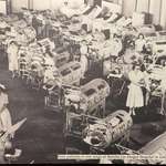 image for Polio patients at Rancho Los Amigos Hospital in California, 1955 - Mutter Museum Philadelphia