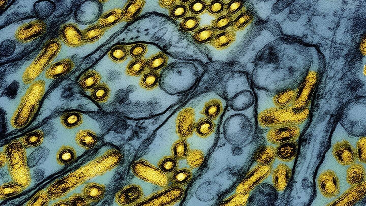 image for First US bird flu death is announced in Louisiana