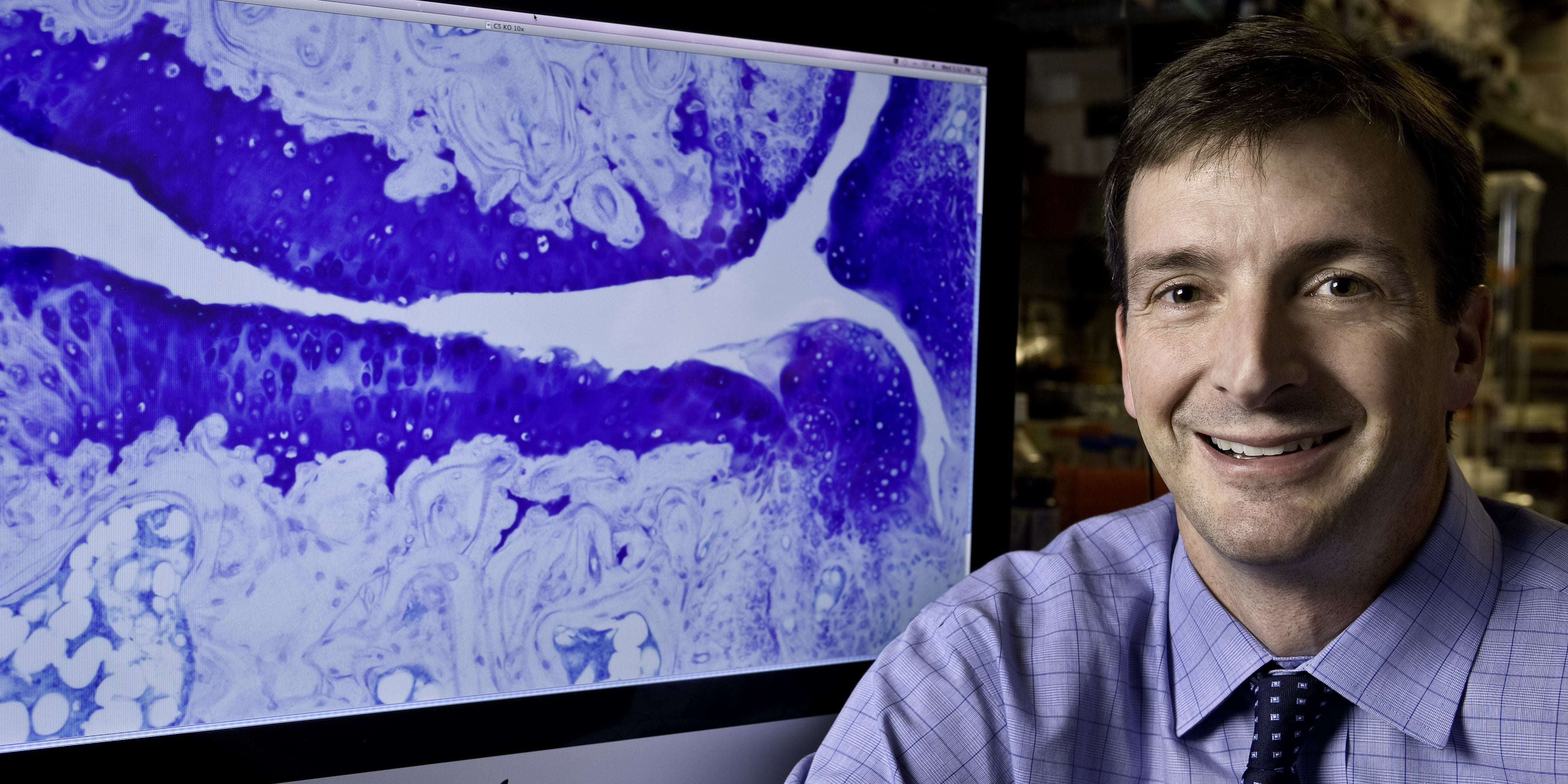 image for Study identifies how Epstein-Barr virus triggers multiple sclerosis