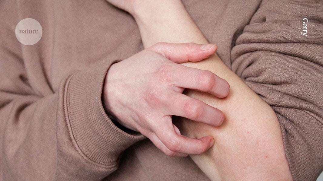 image for Why it feels good to scratch that itch: the immune benefits of scratching