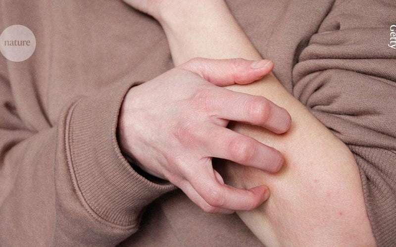 image for Why it feels good to scratch that itch: the immune benefits of scratching