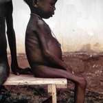 image for Malnourished girl. Biafra. Where USAID intervened.