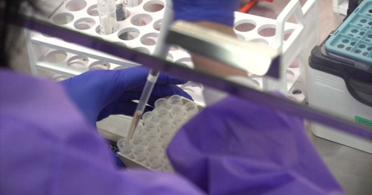 image for First human bird flu case reported in Ohio, Department of Health confirms