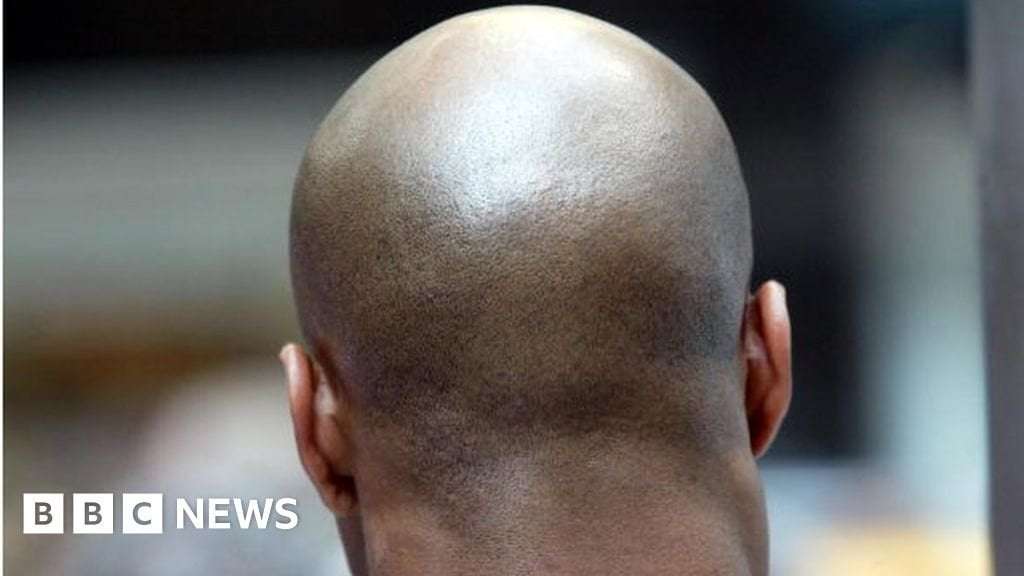 image for Mozambique police warn bald men after ritual attack