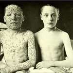 image for A stark reminder of vaccine history.