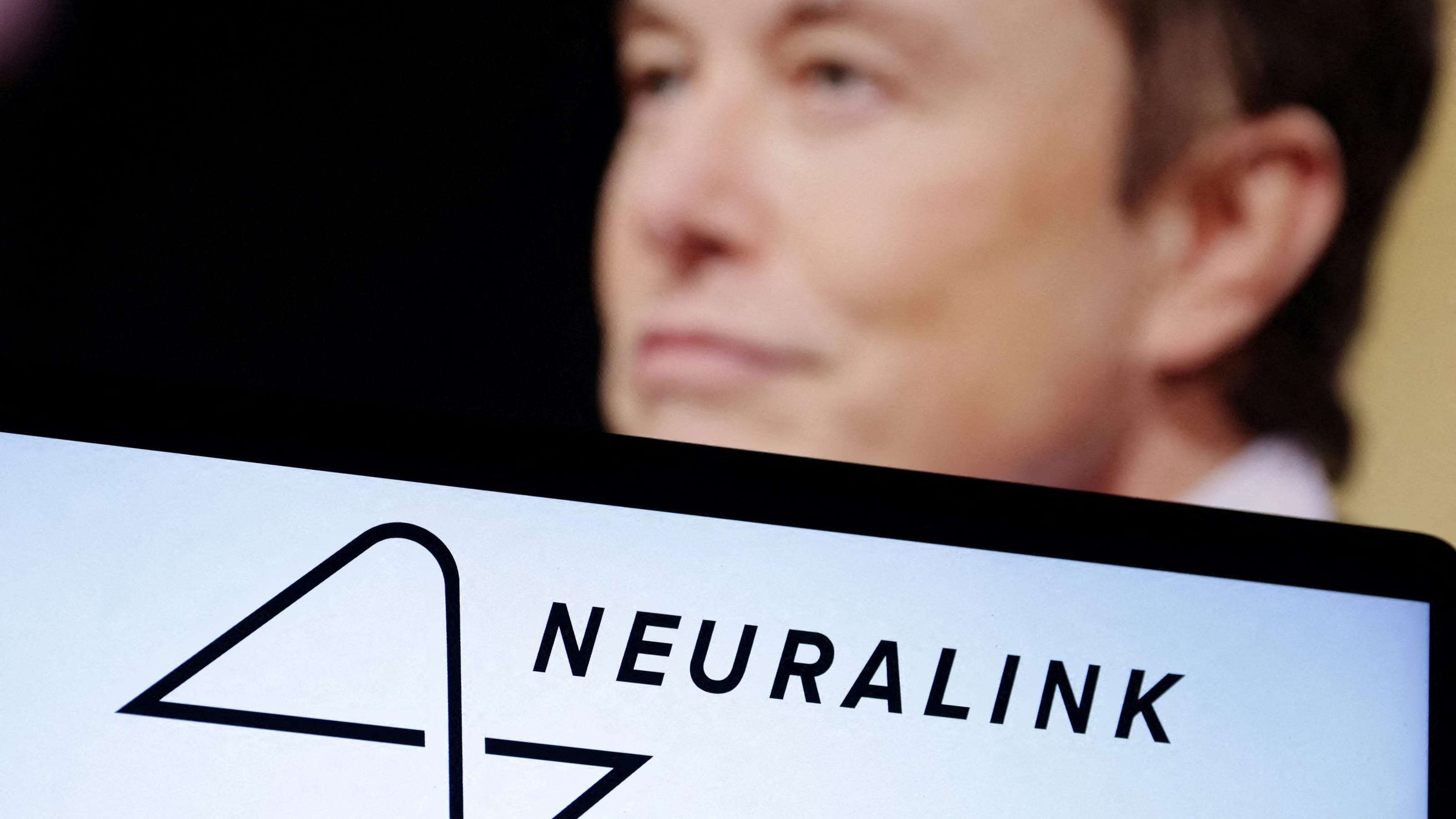image for FDA staff were reviewing Elon Musk’s brain implant company. DOGE just fired them.