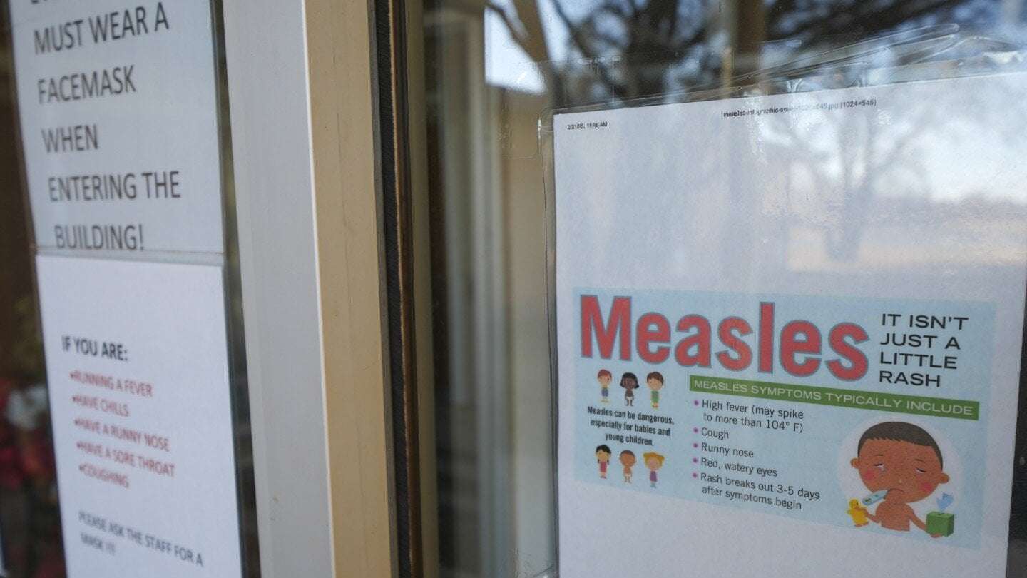 image for An unvaccinated child has died in the Texas measles outbreak