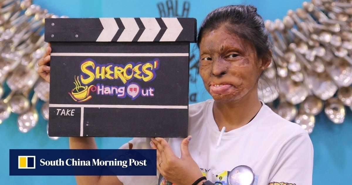 image for Indian cafes that employ acid attack victims help fund their treatment and rehabilitation