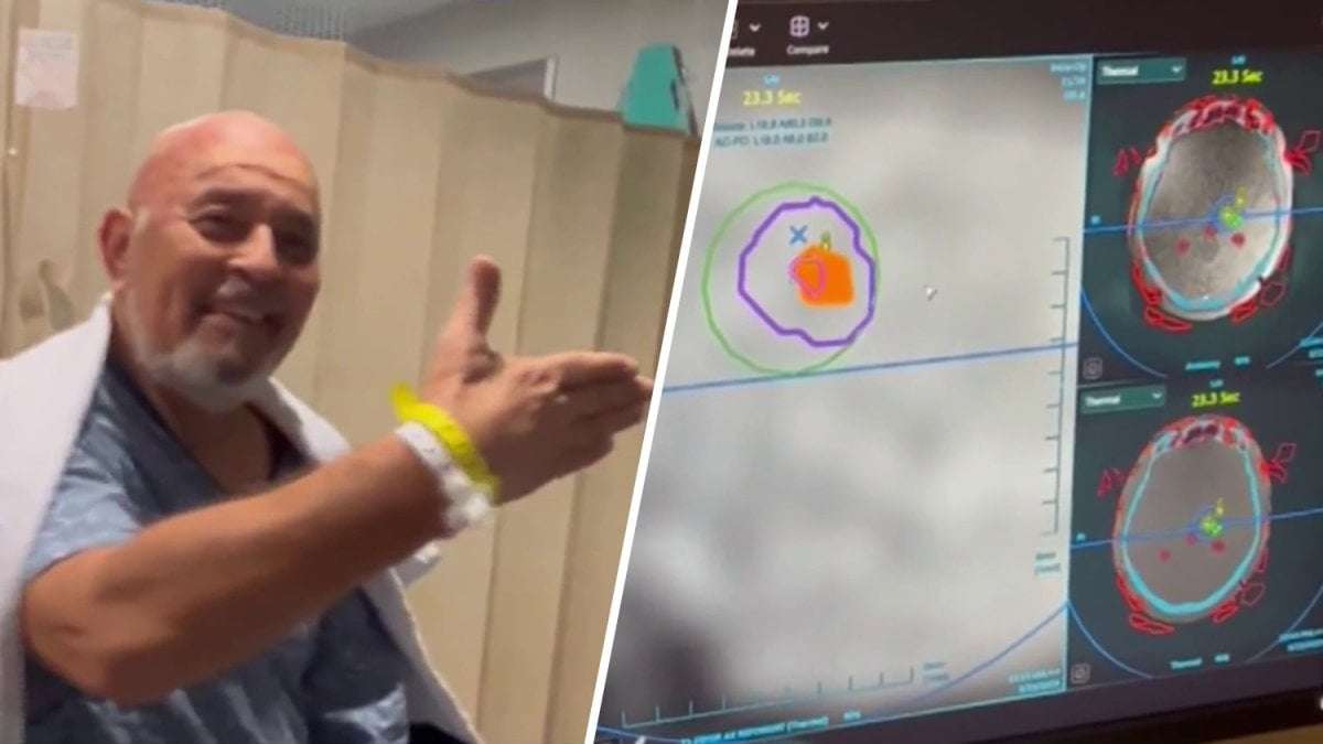image for Innovative ultrasound treatment helps South Florida man living 30+ years with tremor