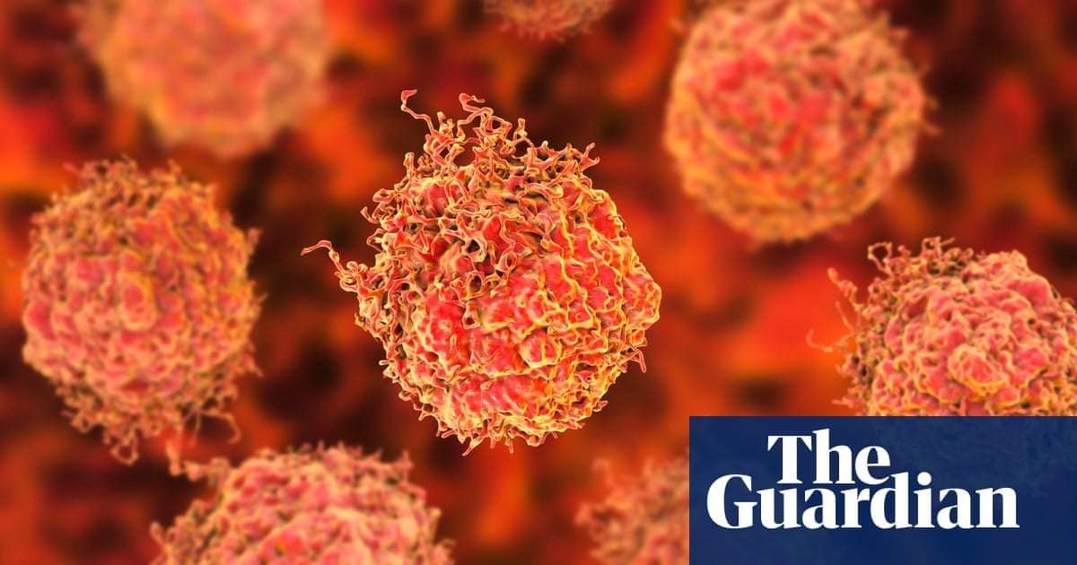 image for Prostate cancer surgery breakthrough offers hope for erectile function