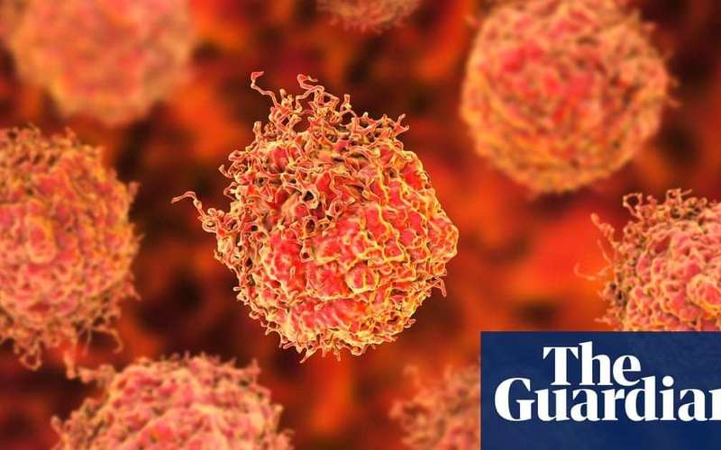 image for Prostate cancer surgery breakthrough offers hope for erectile function