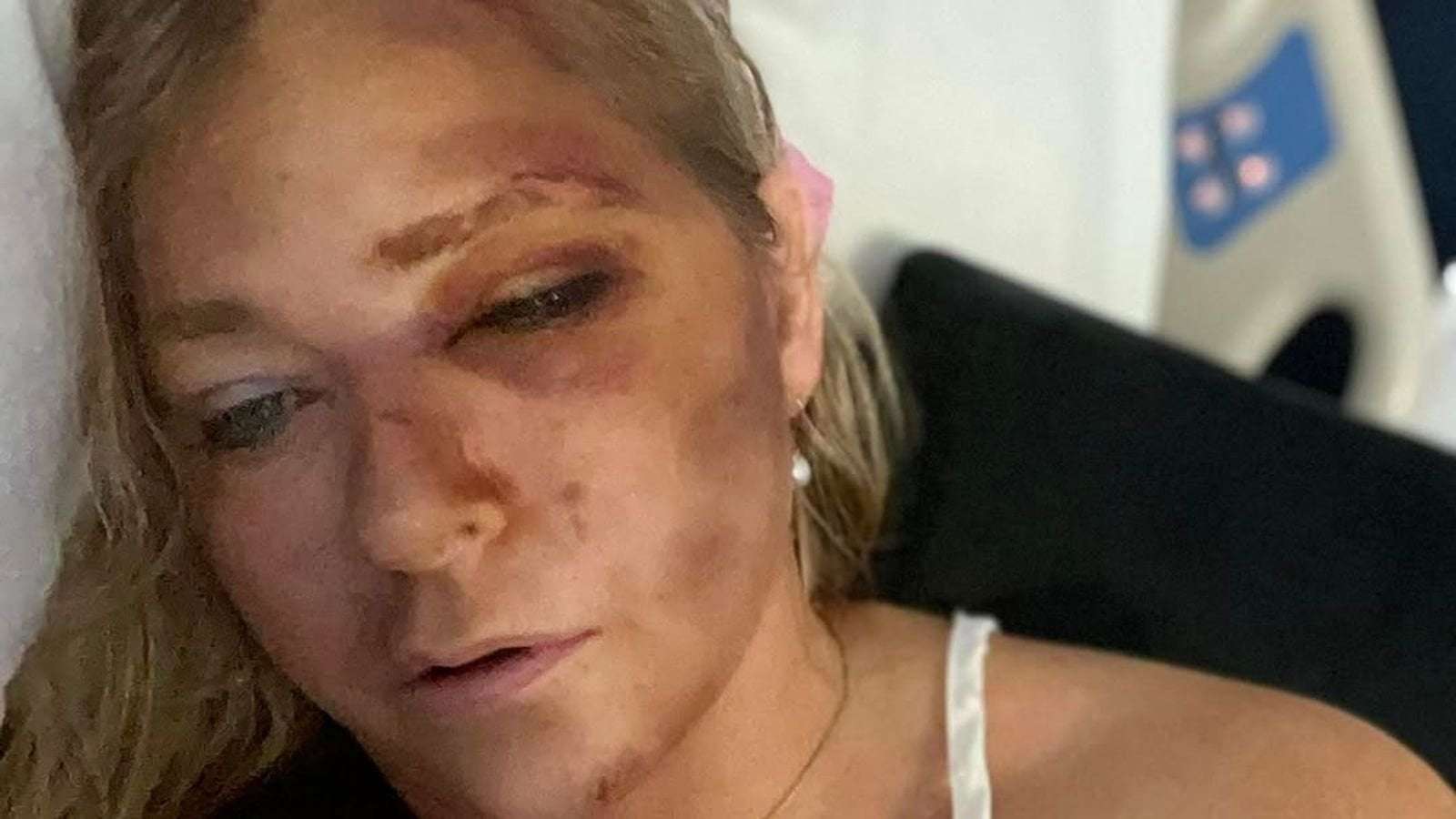 image for Virginia Giuffre, who accused Prince Andrew of sexual assault, says she has days to live after car crash