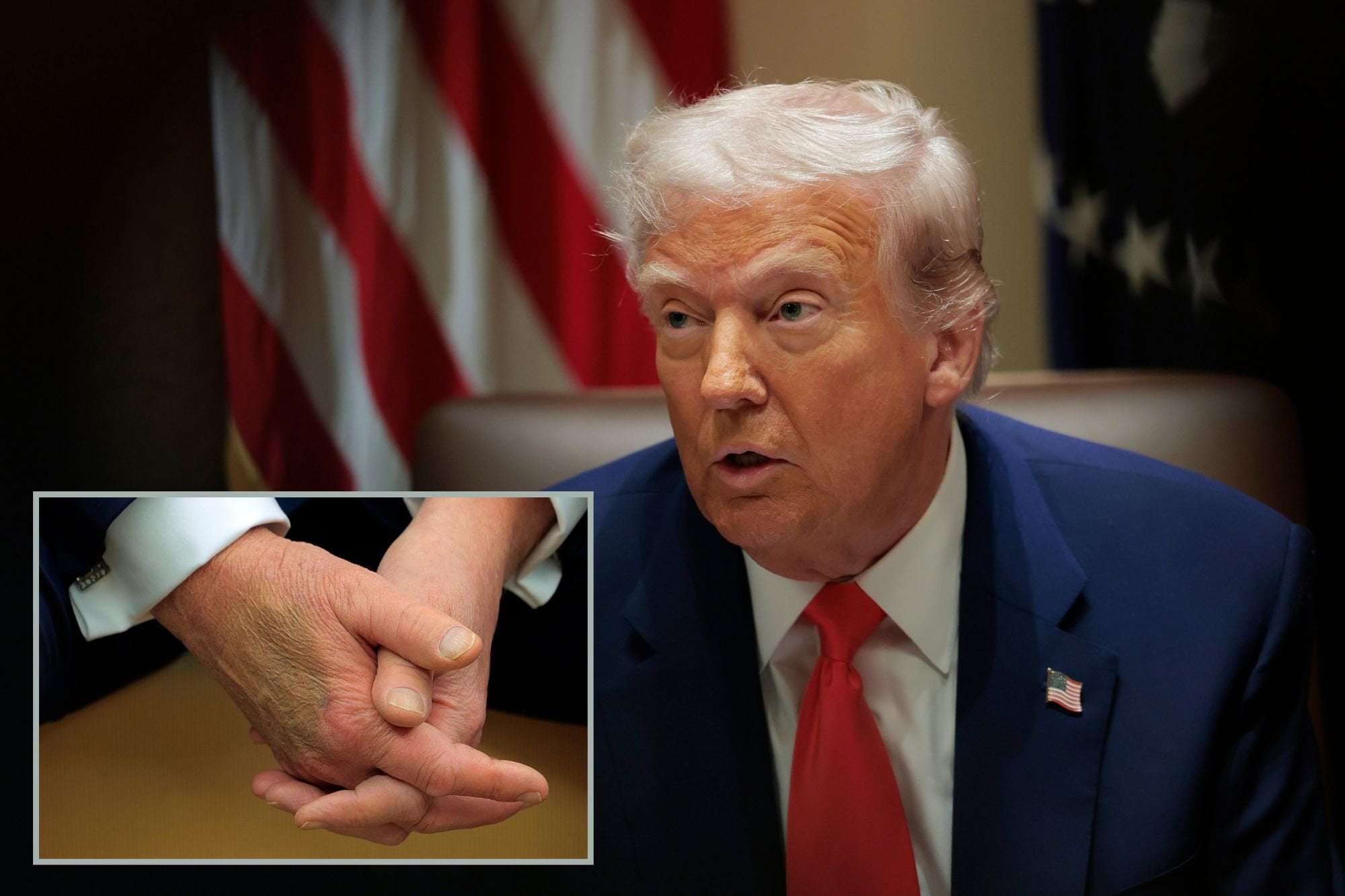 image for Trump's Nearly 5-Hour Physical Exam Raises Questions About His Health After Massive Bruise Saga