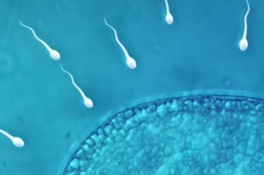 image for 'World's first sperm race' to be held in Los Angeles