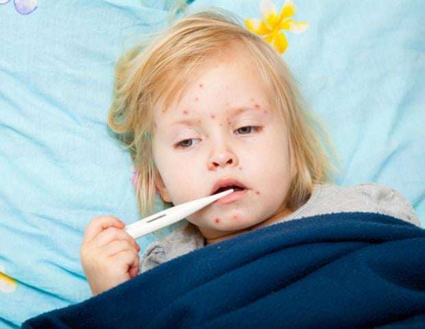 image for Measles could become endemic again in the United States