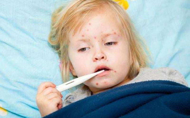 image for Measles could become endemic again in the United States