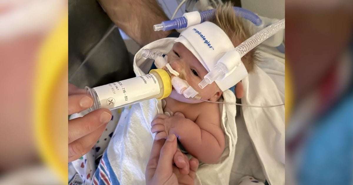 image for Circumcision at NYC hospital almost made baby bleed to death, parents say