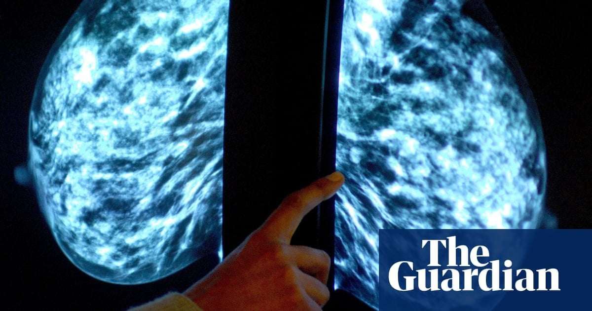 image for NHS could start offering breast cancer checks to women in their thirties