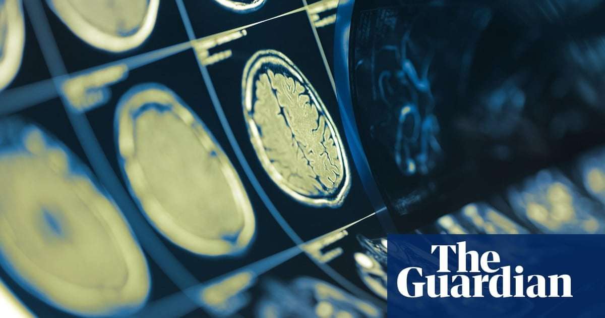 image for ‘Gift of life’: experts hail neck and head cancer breakthrough