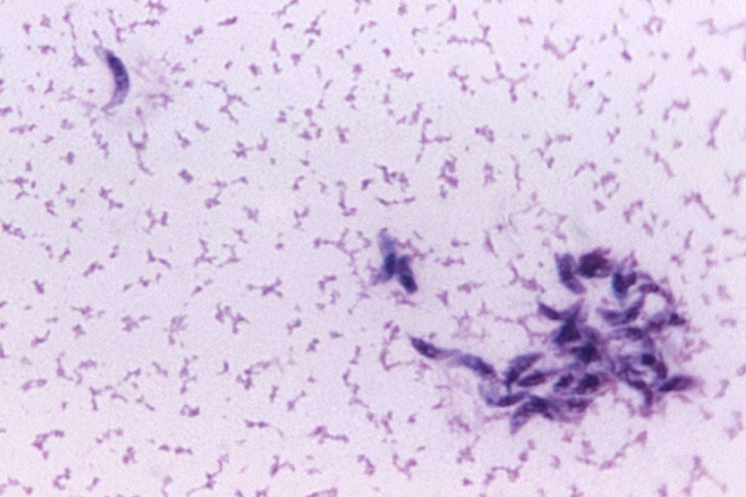 image for This Cat Poop Parasite Can Decapitate Sperm—and It Might Be Fueling Infertility