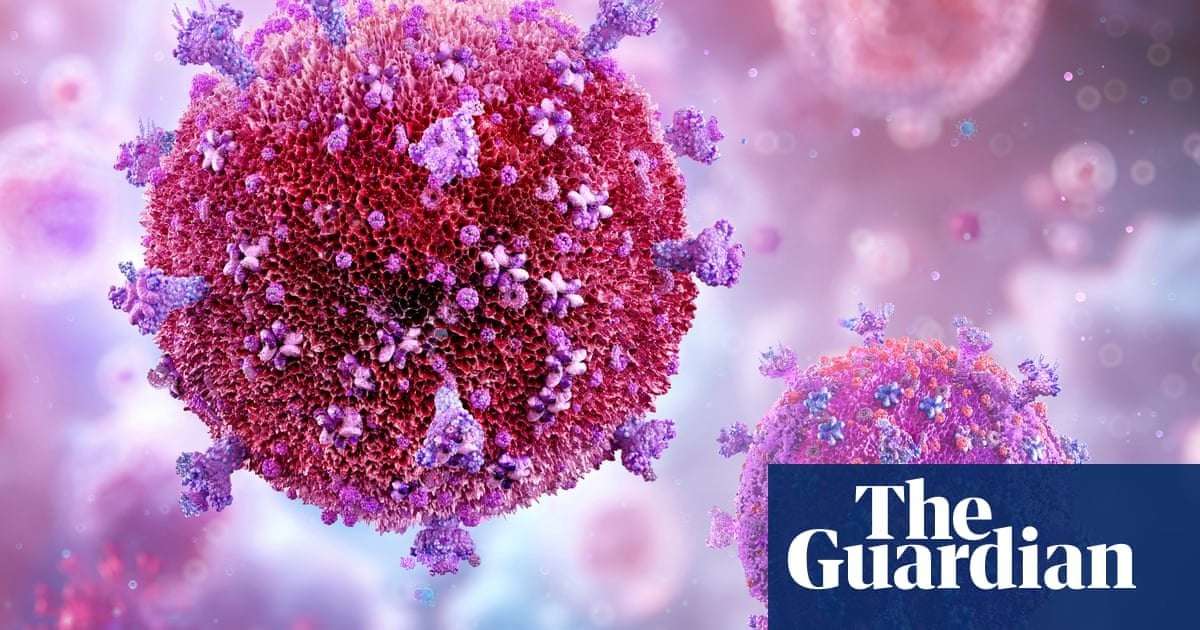 image for Breakthrough in search for HIV cure leaves researchers ‘overwhelmed’