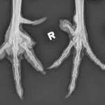image for The X-ray of Donald's bone-spurs has been released...