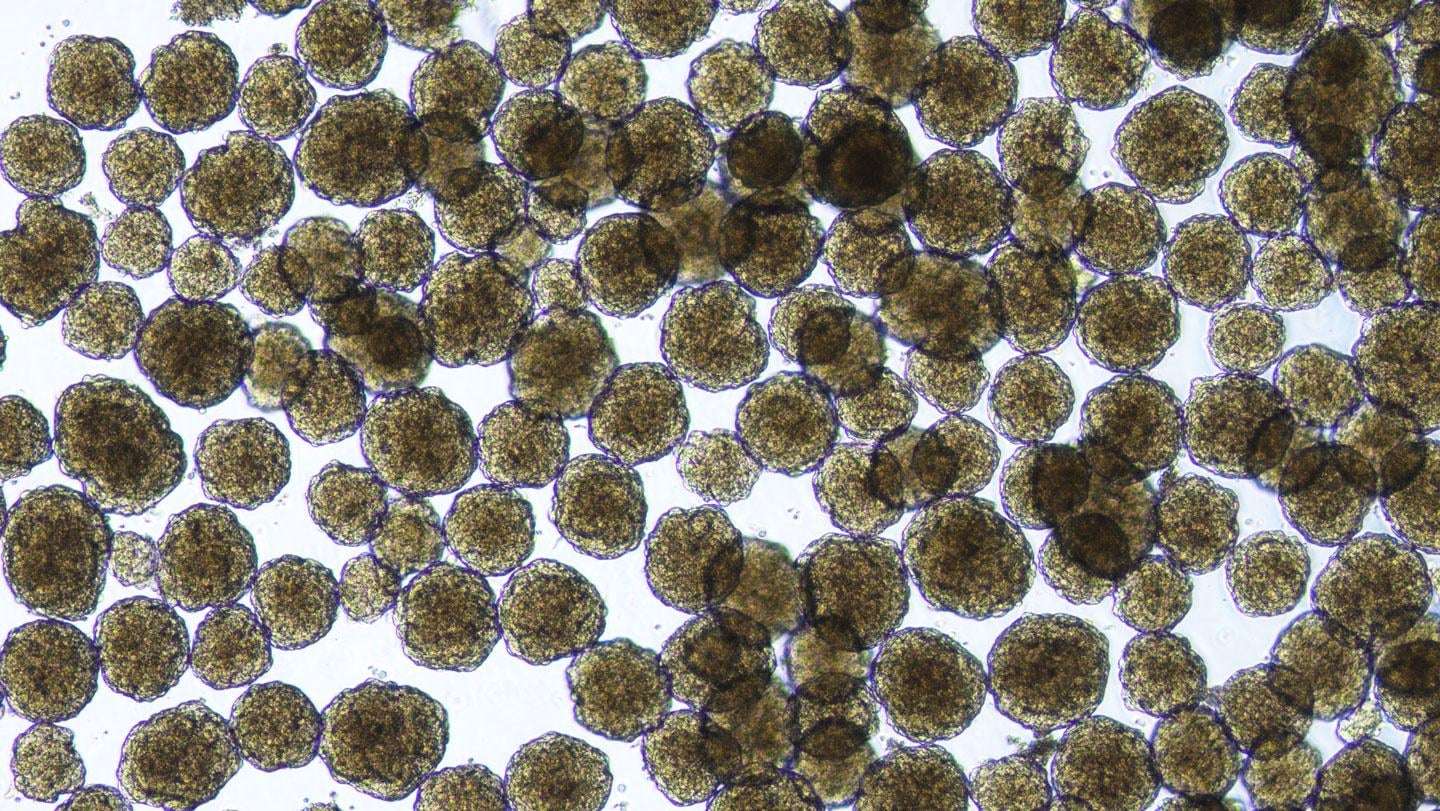 image for A new diabetes treatment could free people from insulin injections